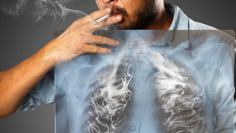Những thói quen giúp phòng ngừa ung thư phổi hiệu quả